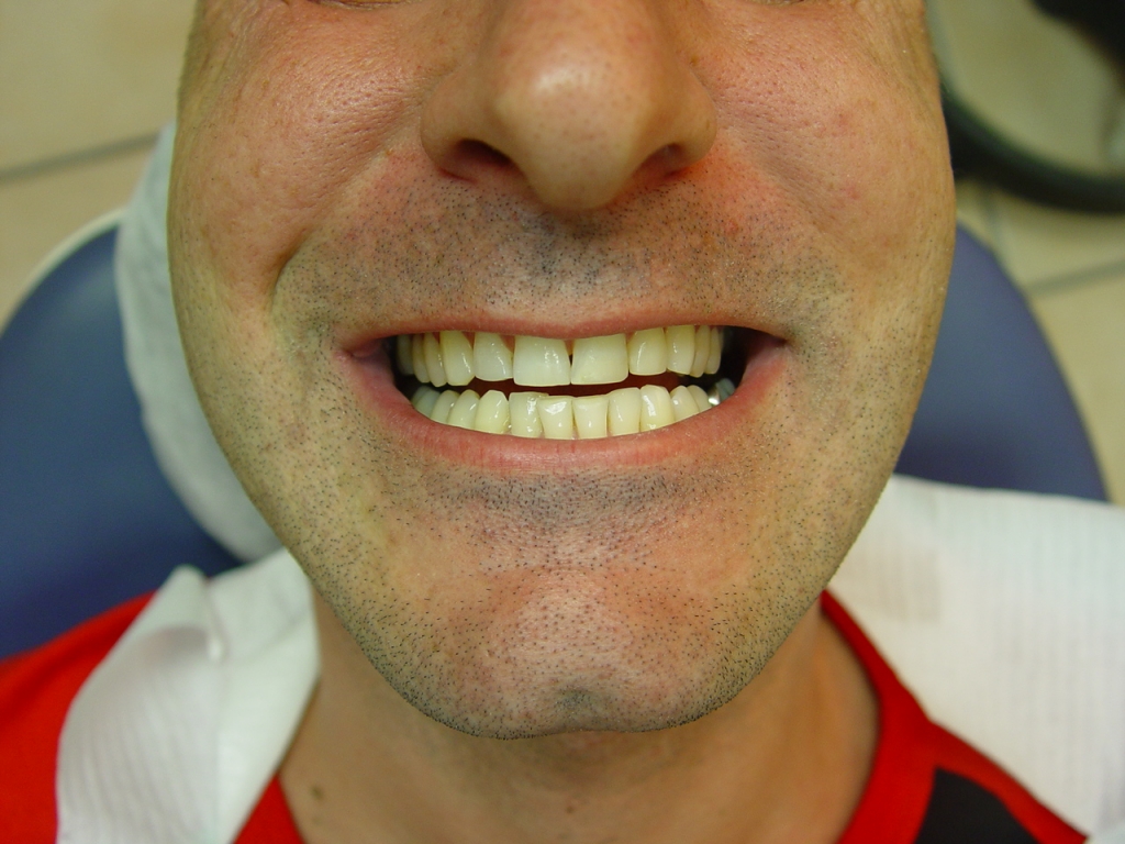 אחרי - 6 פברואר