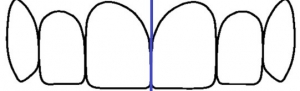 ציר הסימטריה בין שני צדי הלסת