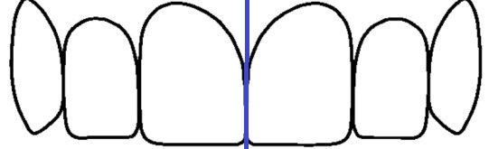 ציר הסימטריה בין שני צדי הלסת